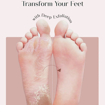 SAVOREA™ ExfoSole Mask